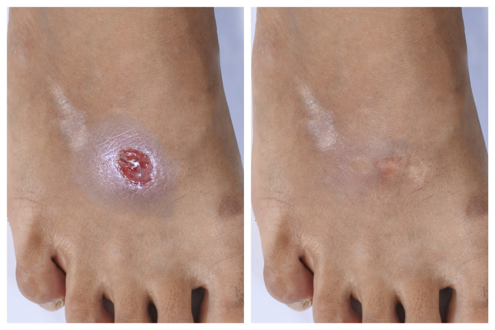 Wound Care (entrance from Neptune Avenue)